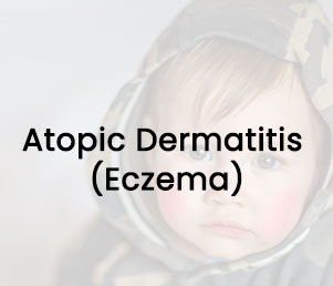 Atopic Dermatitis (Eczema) at Allergy and Asthma Care of Rockland Atopic Dermatitis (Eczema) at Allergy and Asthma Care of Rockland