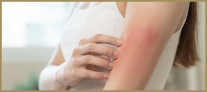 What Are the Different Types of Skin Rashes?  - Allergy & Asthma Care Rockland in Suffern, NY and Monroe, NY